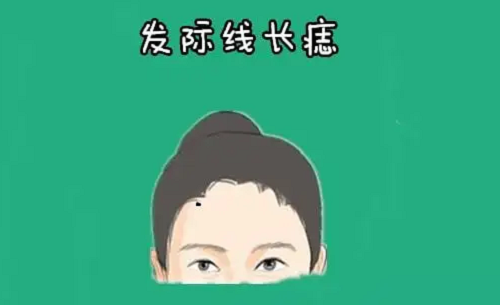 女人发中藏痣图片